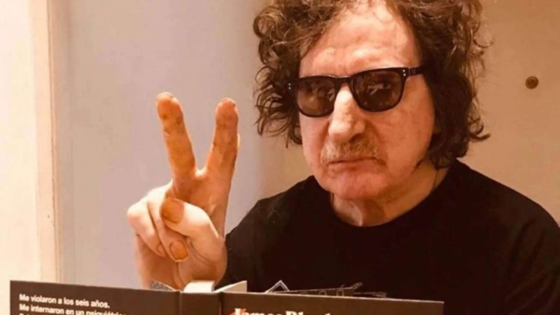 Charly García internado por quemaduras